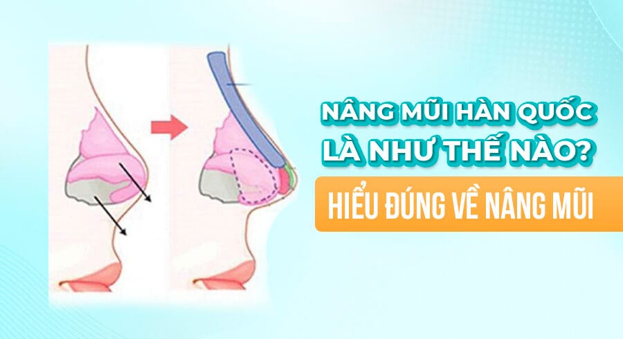 co-nen-nang-mui-han-quoc-khong-5-luu-y-dung-bo-lo