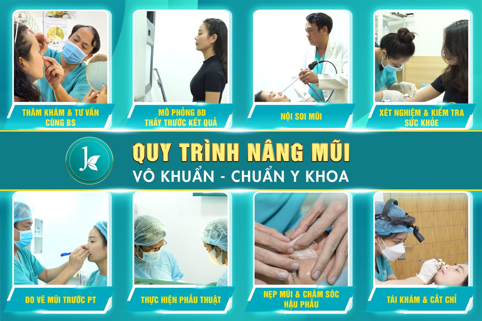 Quy trình nâng mũi chuẩn y khoa