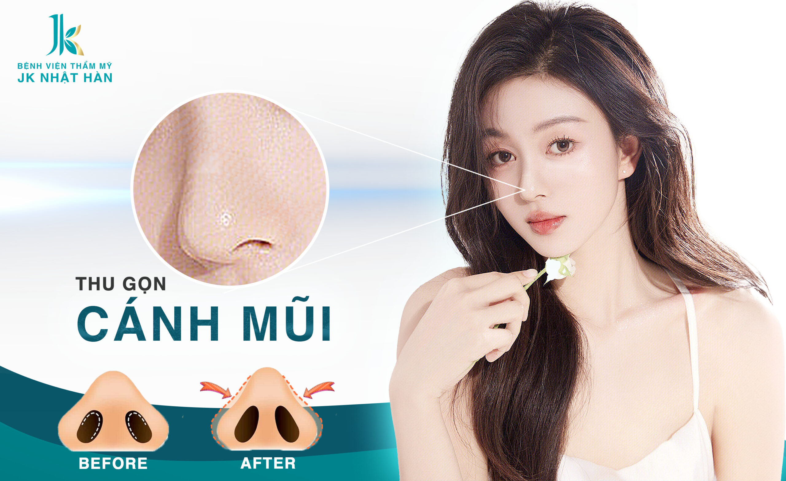 Thu gọn cánh mũi là gì?