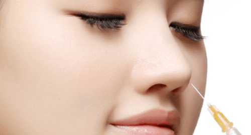 Phương pháp Radies phù hợp với chiếc mũi ít khuyết điểm