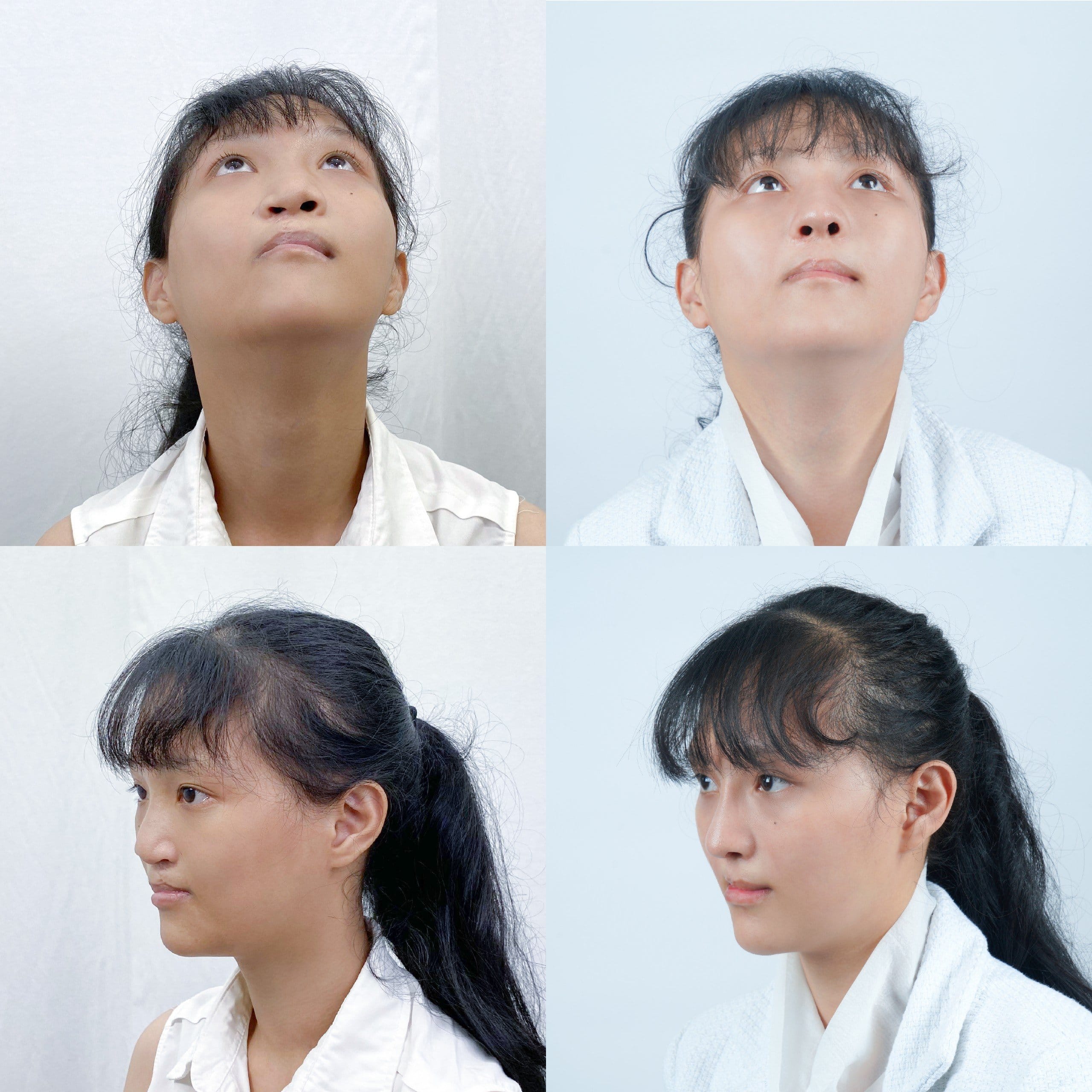 sut-moi-ho-ham-ech-nguyen-nhan-la-gi