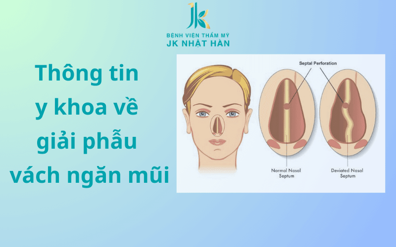 Thông tin y khoa về giải phẫu vách ngăn mũi