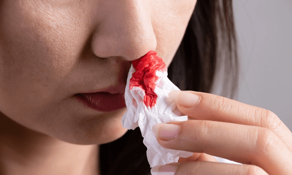 Một số bệnh lý liên quan đến vách ngăn mũi