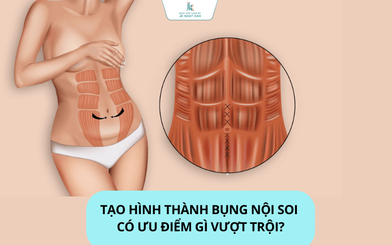 Tạo hình thành bụng nội soi tại JK nhật hàn