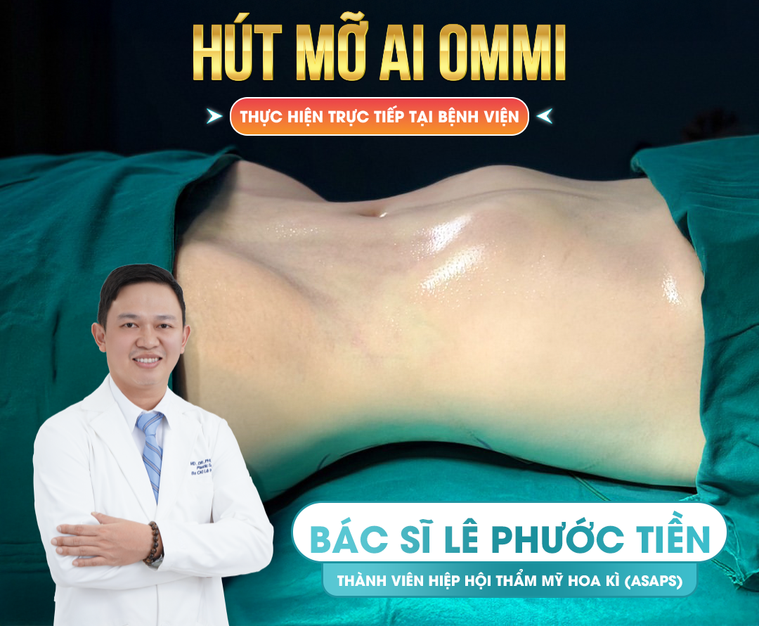 Hút mỡ AI Ommi - Công nghệ tiên tiến giải quyết mọi lo lắng của khách hàng