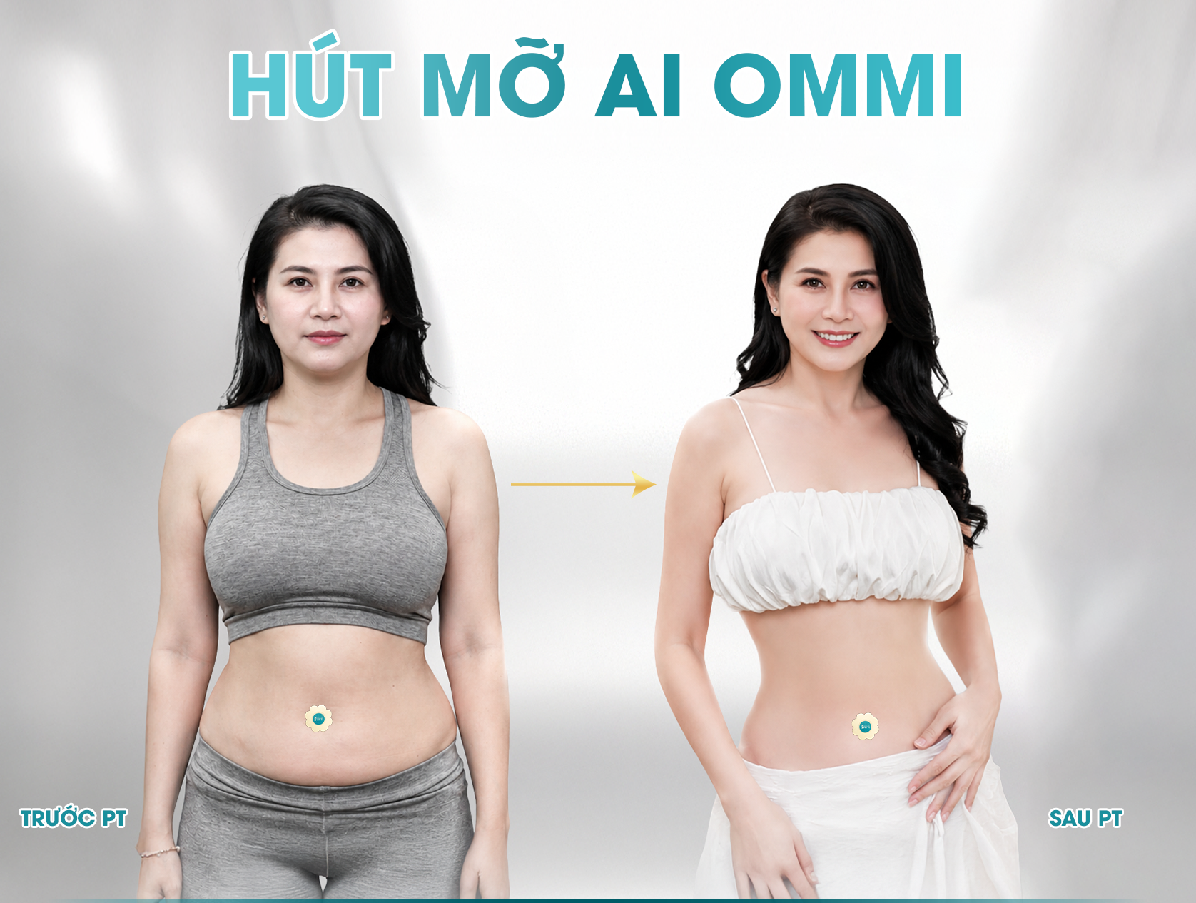 Khách hàng hút mỡ AI Ommi tại JK Nhật Hàn