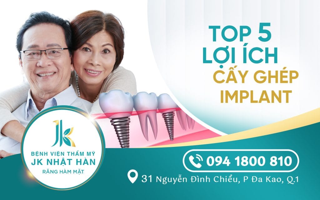 loi-ich-cay-ghep-implant