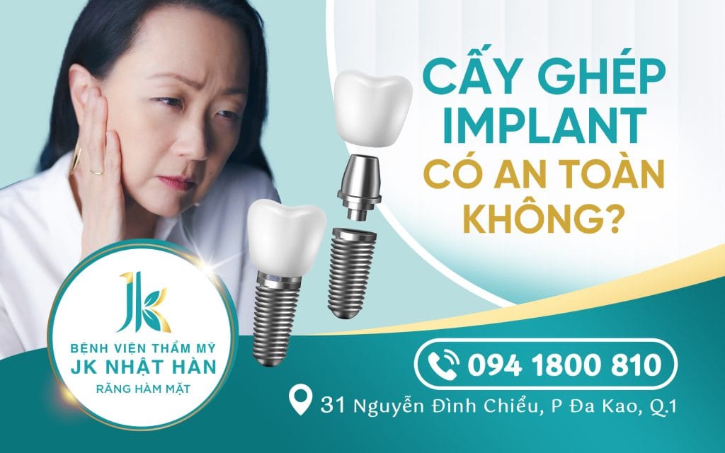 cay-ghép-implant-co-an-toan-khong