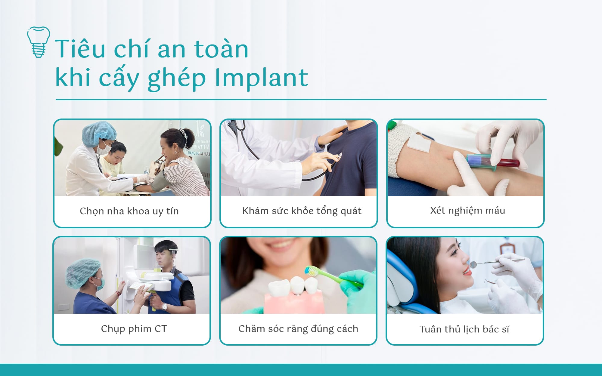 cay-ghep-implant-co-an-toan-khong