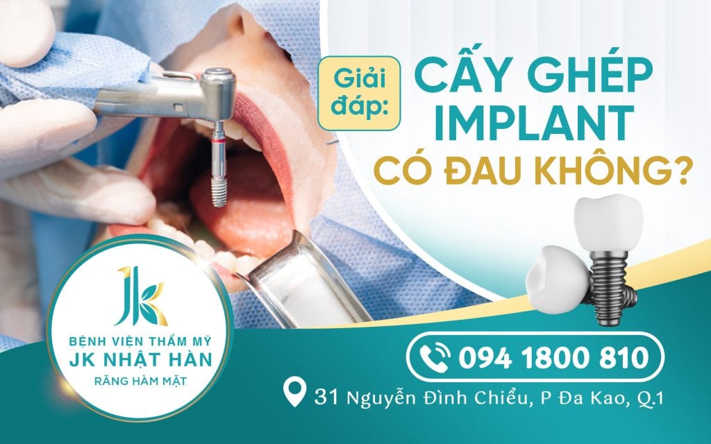 cay-ghep-implant-co-dau-khong