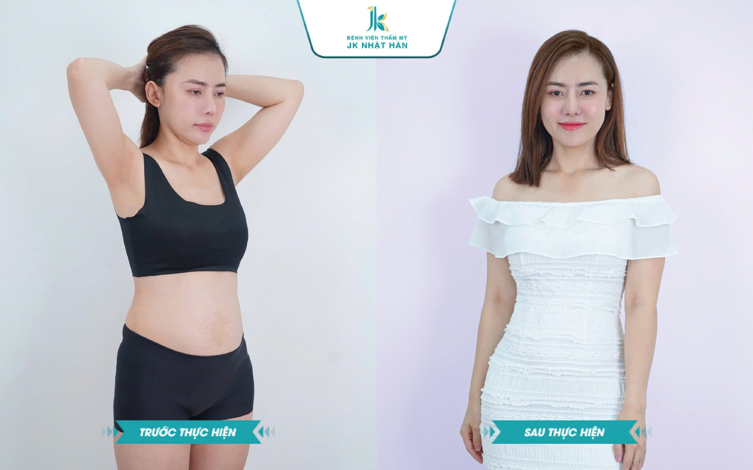 Lời khuyên cho những ai có ý định hút mỡ toàn thân