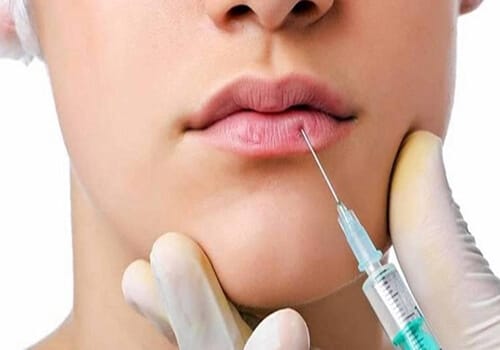 Những phương pháp sửa môi nam phổ biến