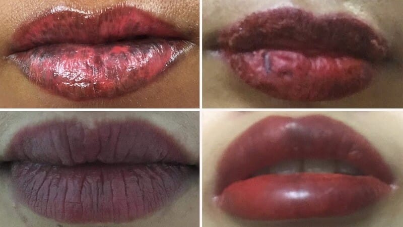 Các dạng môi bị hỏng thường gặp hiện nay