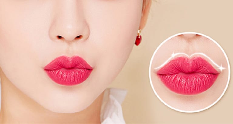 Vì sao thẩm mỹ môi ngày càng được ưa chuộng?