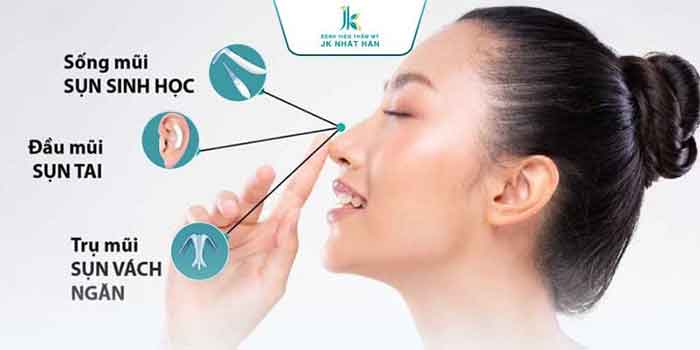 Chất liệu sụng nâng mũi