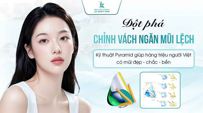 Đột phá chỉnh vách ngăn mũi lệch pyramid