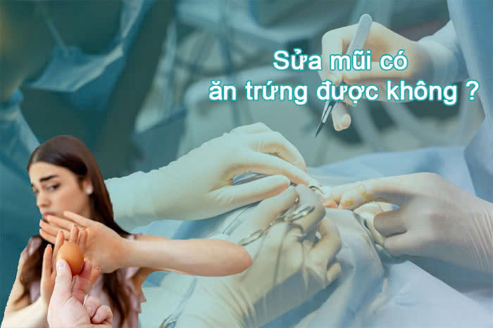 Sửa mũi có ăn trứng được không?