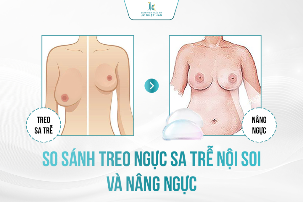 Treo ngực sa trễ nội soi hay nâng ngực tốt hơn?