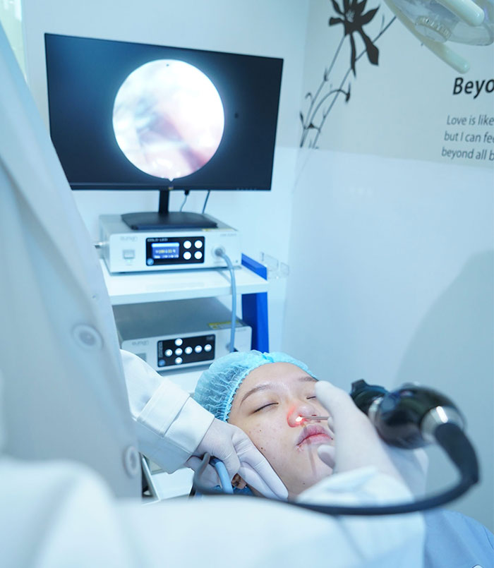 Bác sĩ thực hiện nội soi để xác định độ lệch của vách ngăn mũi