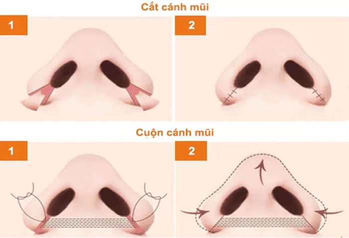 Cắt cánh mũi và cuộn cánh mũi JK Nhật Hàn