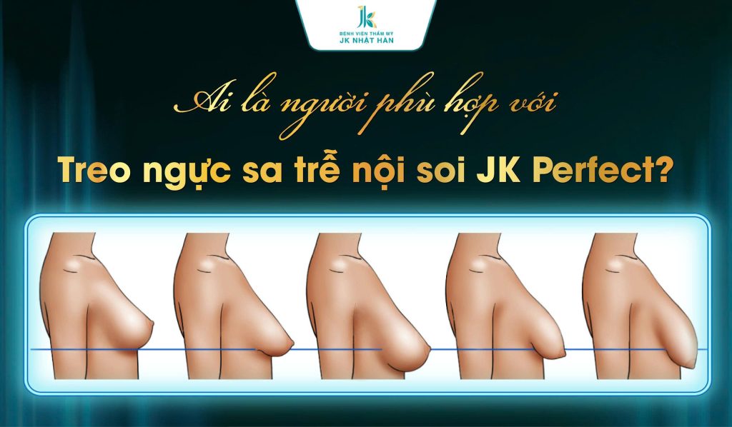 Ai phù hợp với treo ngực sa trễ nội soi JK Perfect?