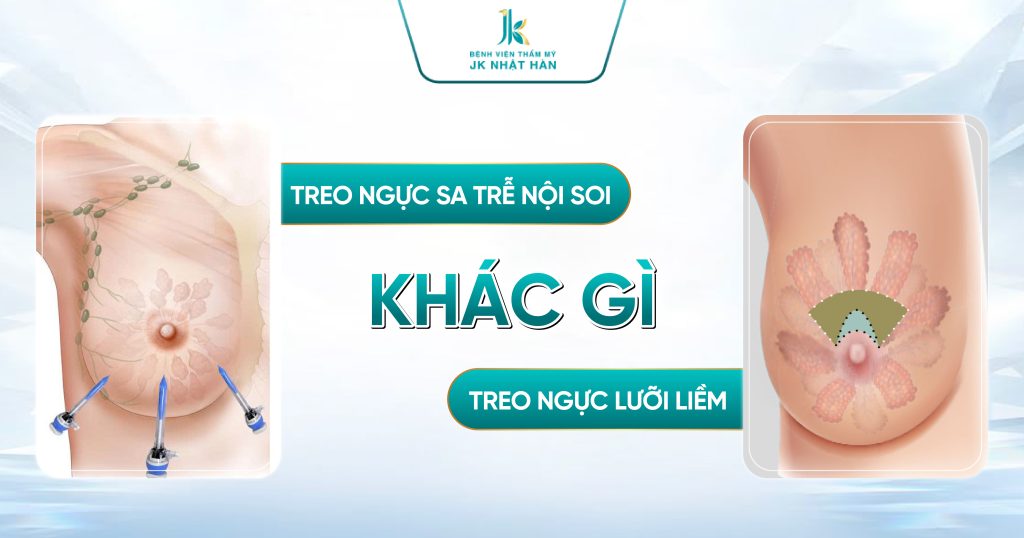 Treo ngực sa trễ nội soi khác gì phương pháp treo ngực lưỡi liềm?