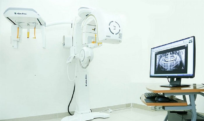 Máy chụp CT Cone Beam 3D