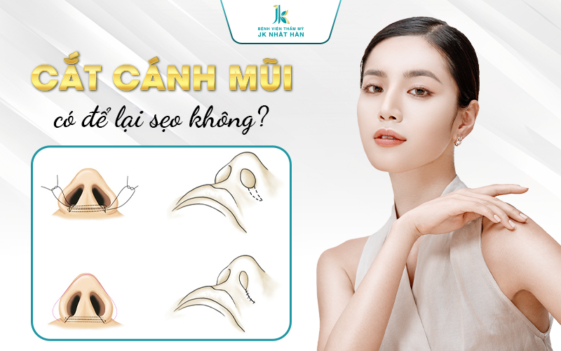 cắt cánh mũi có để lại seo không?