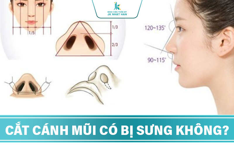 Cắt cánh mũi có bị sung không?