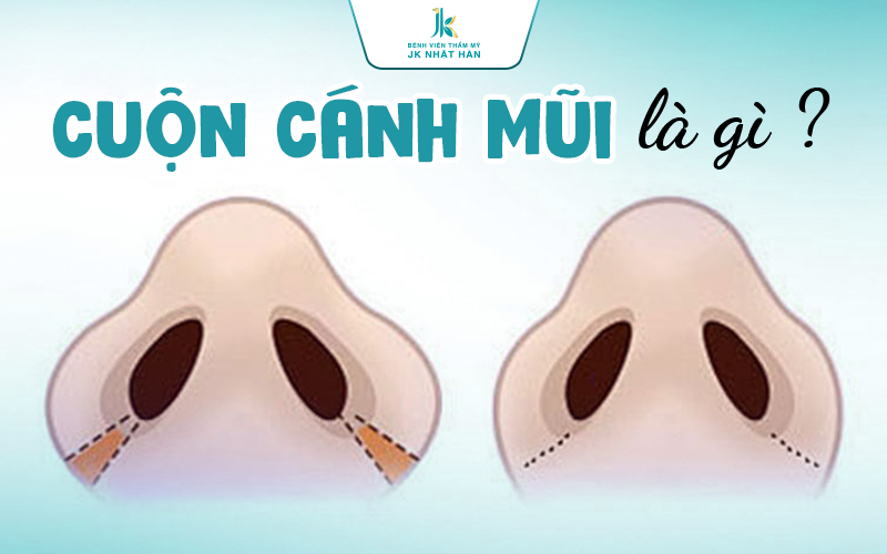 Cuộn cánh mũi là gì