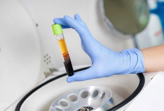 Quy trình cấy mỡ tự thân Nanofat chuẩn y khoa tại JK Nhật Hàn