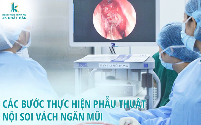 Các bước thực hiện nội soi vách ngăn mũi
