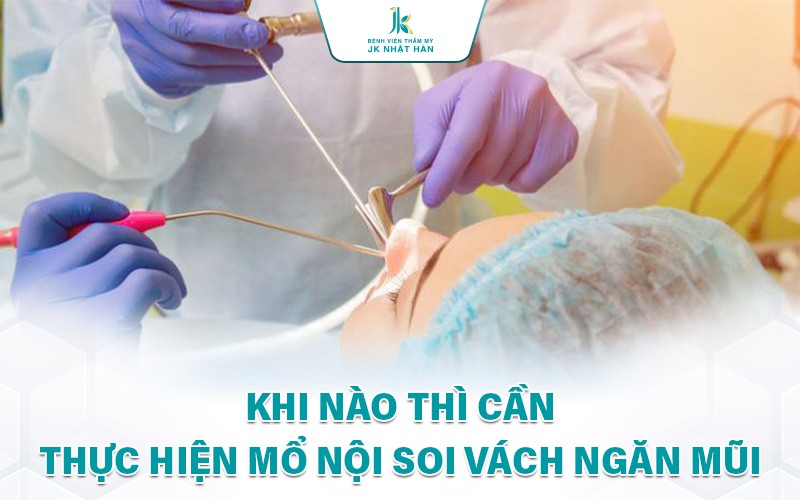 Nội soi vách ngăn mũi