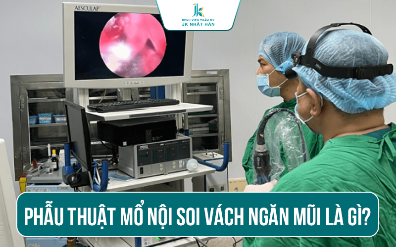 Phẫu thuật mổ nội soi vách ngăn mũi