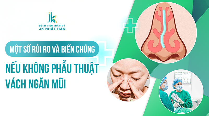 Rủi ro khi không phẫu thuật vách ngăn mũi