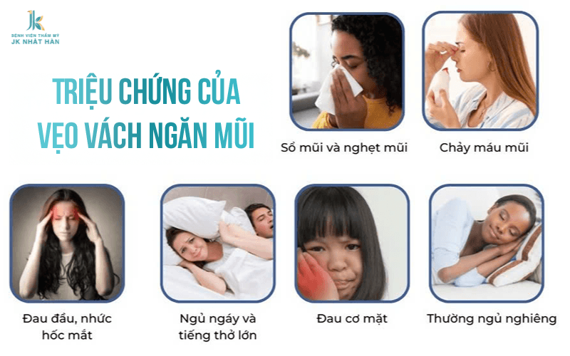 Vẹo vách ngăn mũi là gì?