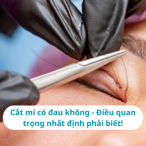Cắt mí có đau không? Điều quan trọng nhất định phải biết!
