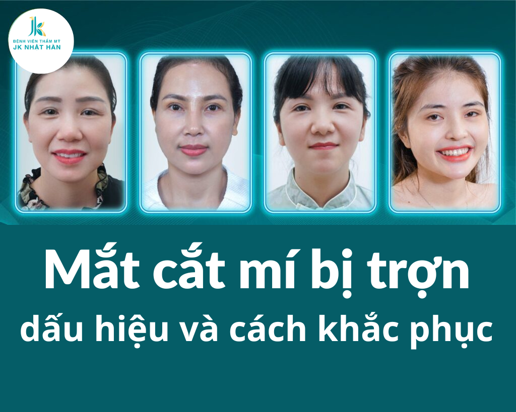 Mắt cắt mí bị trợn: Dấu hiệu và cách khắc phục