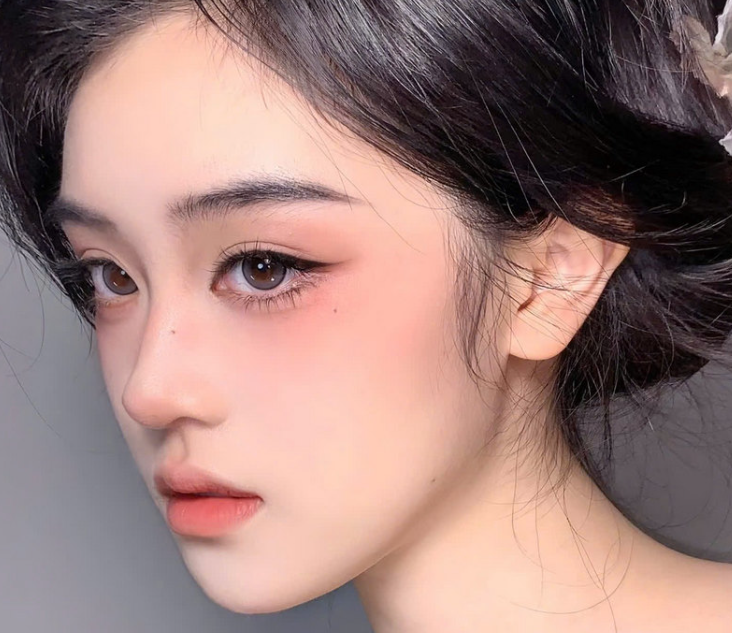 Cắt mí Trung Hoa - Những điều cần biết