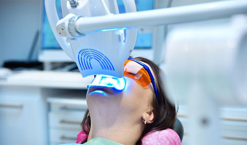 Phương pháp tẩy trắng răng bằng laser