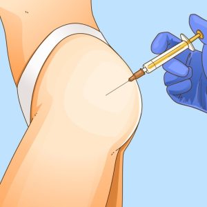 Biến chứng tiêm silicone