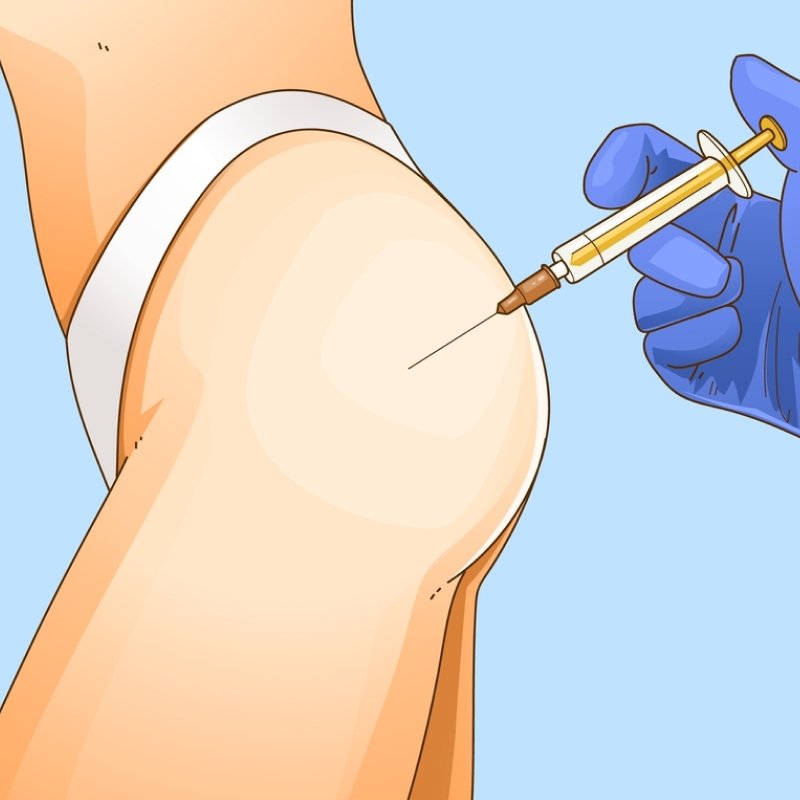 Biến chứng tiêm silicone