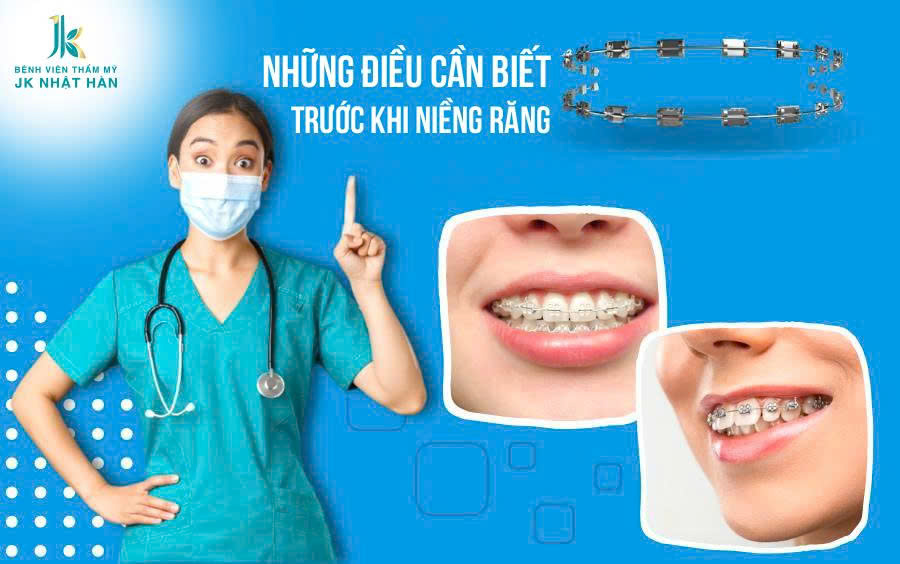 Niềng răng - chỉnh nha