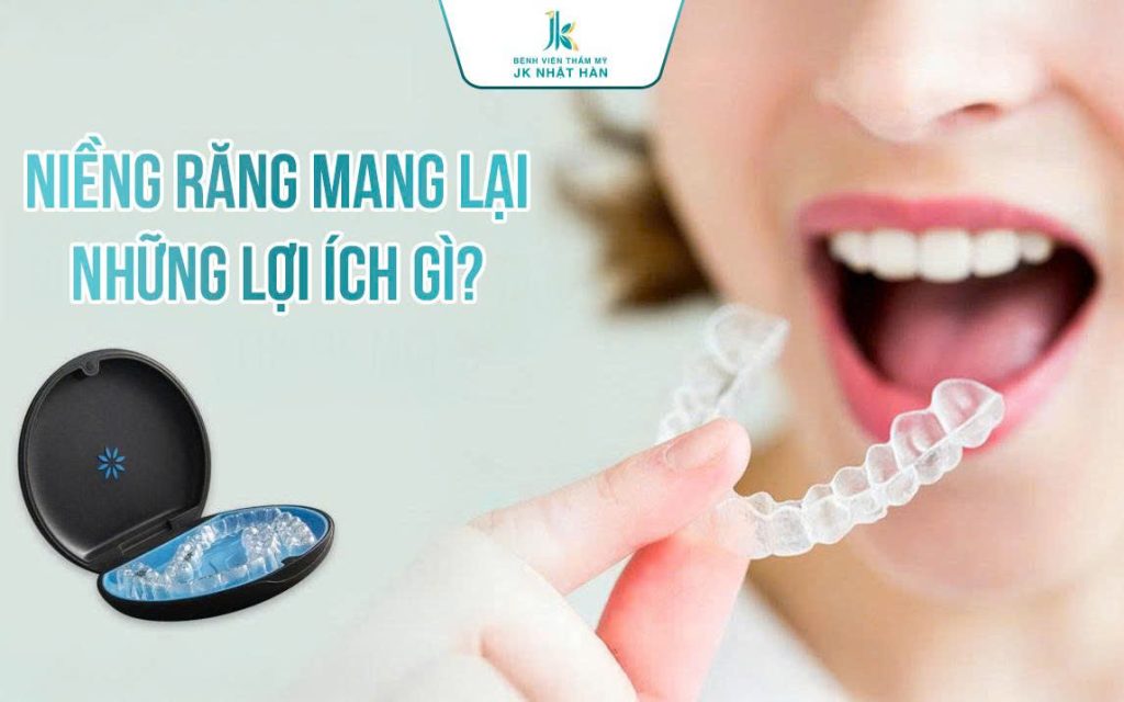 Niềng răng - chỉnh nha