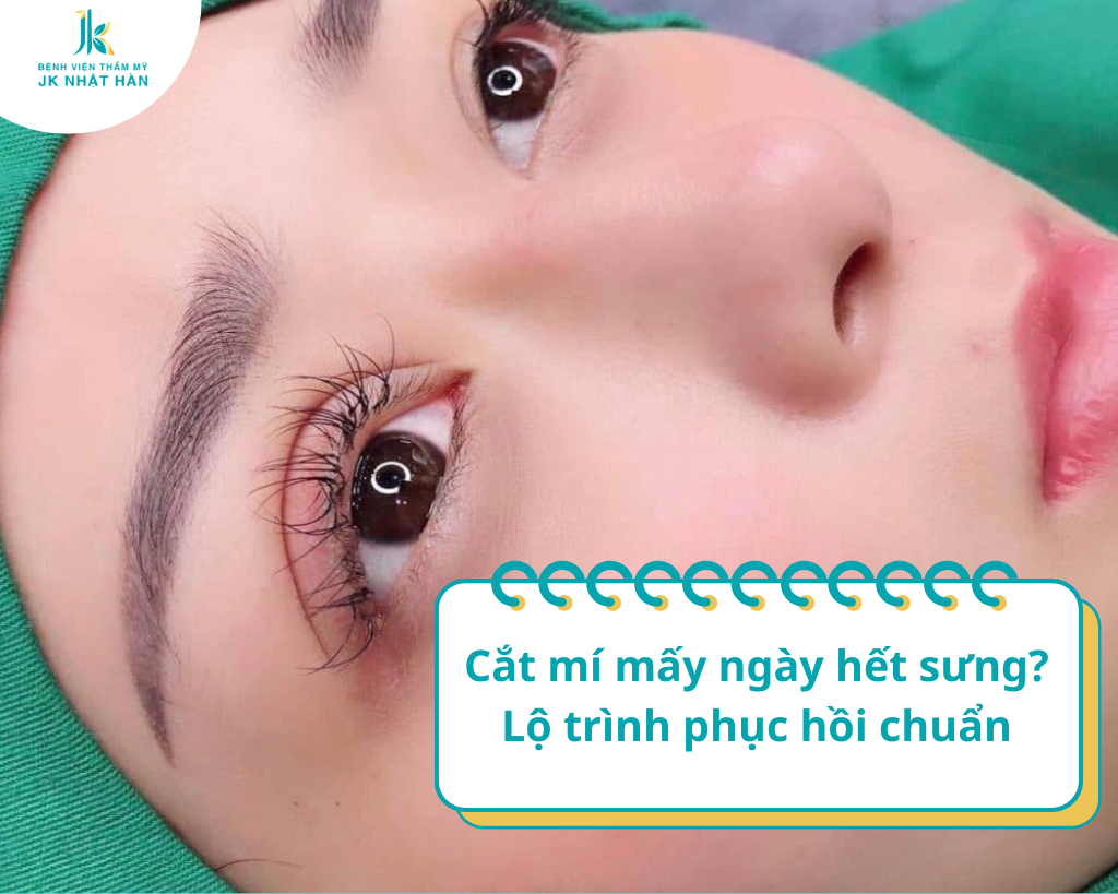 Cắt mí mấy ngày hết sưng? Lộ trình phục hồi chuẩn
