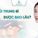 Nâng mũi trung bì giữ được bao lâu