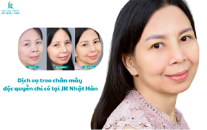 Dịch vụ treo chân mày - Kỹ thuật đặc biệt chỉ có tại JK Nhật Hàn