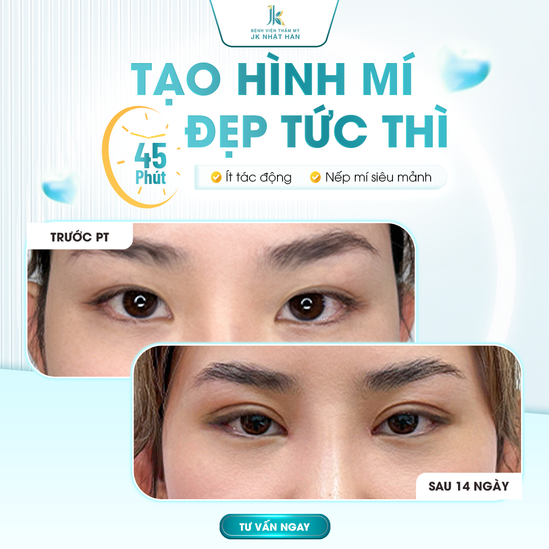 Top 5 địa chỉ cắt mí mắt uy tín được đánh giá cao tại TP.HCM