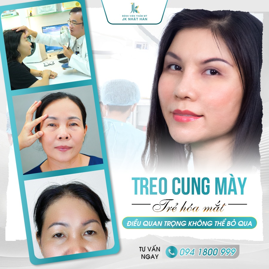 Dịch vụ treo chân mày - Kỹ thuật đặc biệt chỉ có tại JK Nhật Hàn