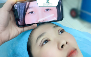 Top 5 địa chỉ cắt mí mắt uy tín tại TP.HCM